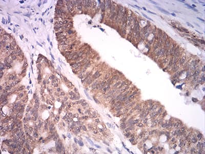 Monoclonal Mouse anti-Human ASH2L / ASH2 Antibody (clone 6B10H10, IHC, WB)