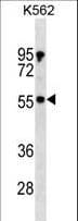 PDPK1 / PDK1 Antibody