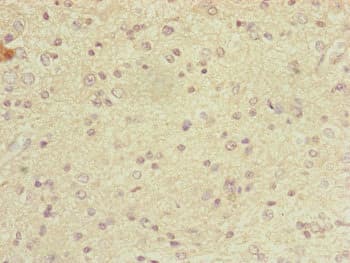 Polyclonal Rabbit anti-Human DYNC2LI1 / D2LIC Antibody (IHC, WB)