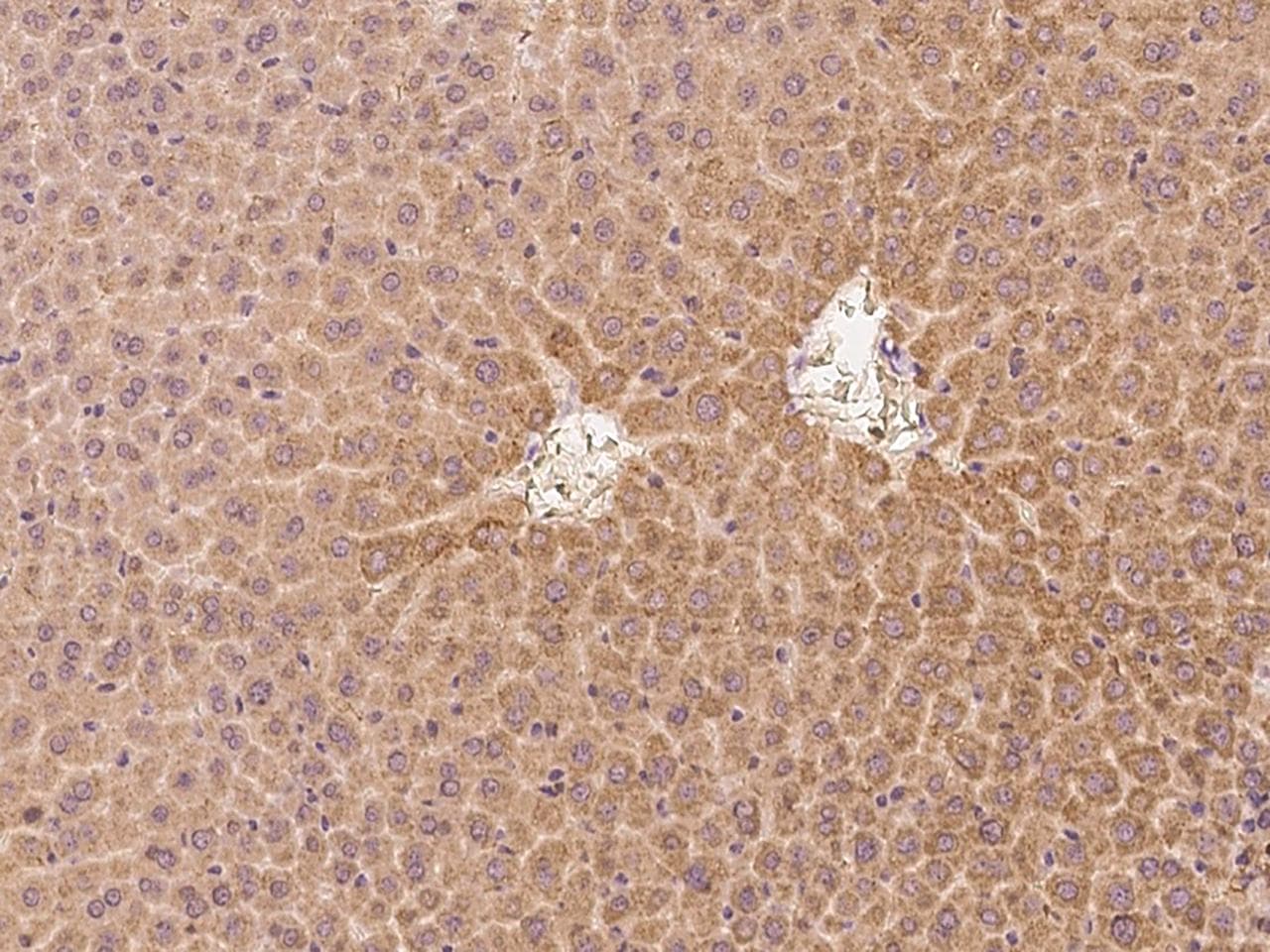 CRABP2 Antibody (Preservative Free)