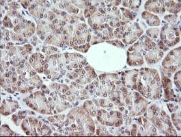 MAP2K3 / MEK3 / MKK3 Antibody (clone OTI4B3)