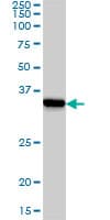 IHC-plus™ SSR1 Antibody (clone 1C11)