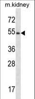 FRK Antibody (aa464-491)