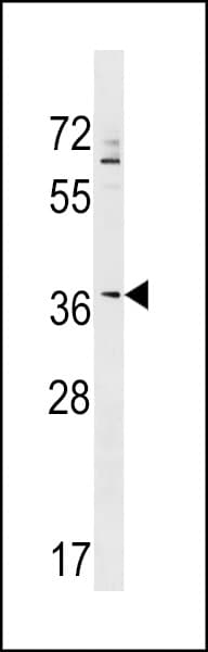 ZNF385A / ZNF385 Antibody (aa57-83)