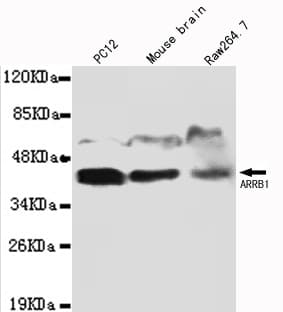 IHC-plus™ Monoclonal Mouse anti-Human ARRB1 / Beta Arrestin 1 Antibody (IHC, WB)