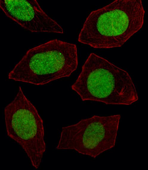 IHC-plus™ Polyclonal Rabbit anti-Human EN1 / Engrailed Antibody (aa1-30, IHC, IF, WB)
