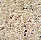 XPO1 / CRM1 Antibody (aa817-846)