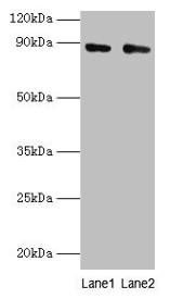 IHC-plus™ CFB / Complement Factor B Antibody (aa23-761)