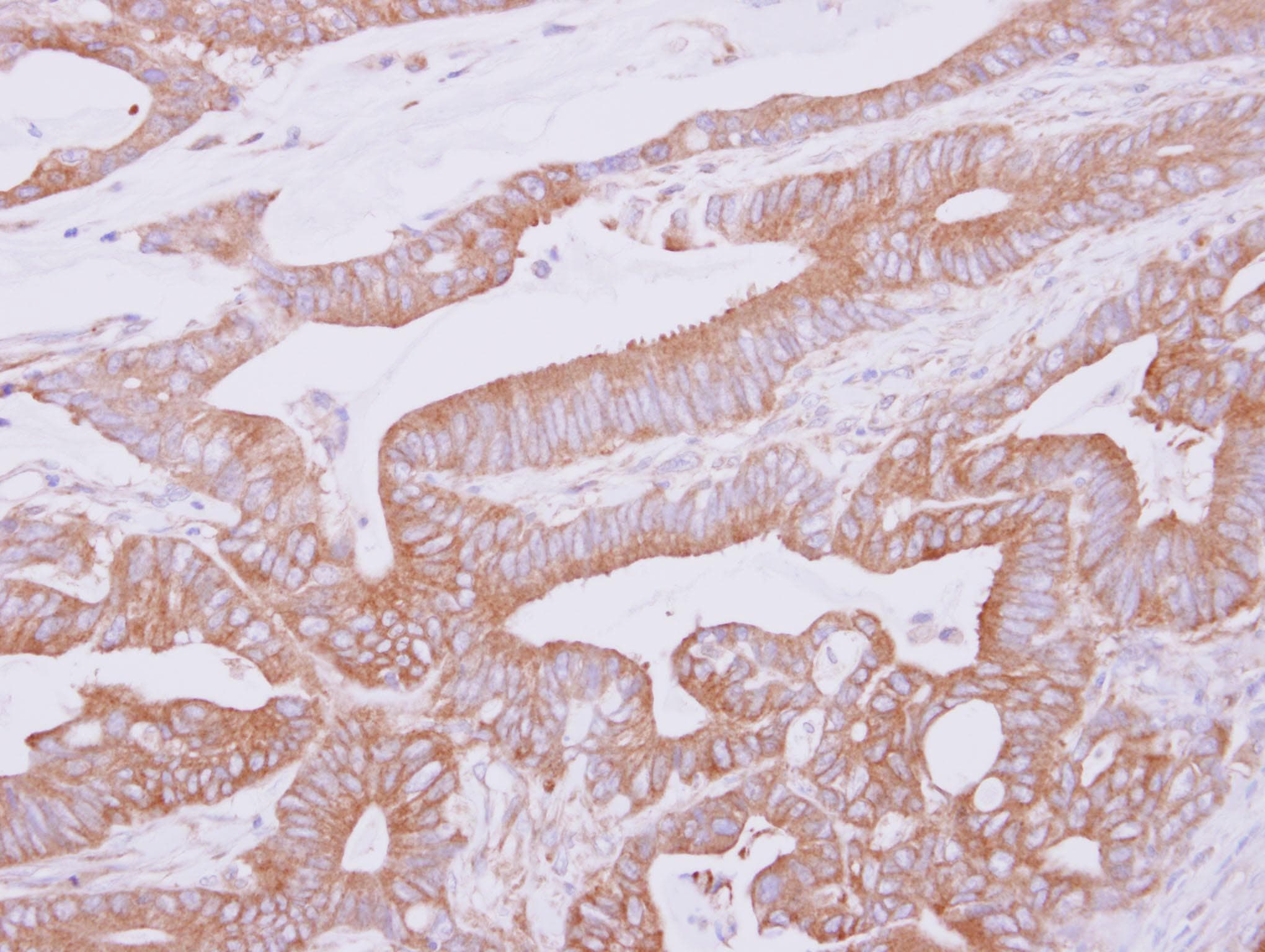 Polyclonal Rabbit anti-Human THUMPD2 Antibody (IHC, WB)