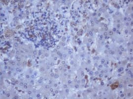Monoclonal Mouse anti-Human DDX59 Antibody (clone OTI2G1, IHC, WB)
