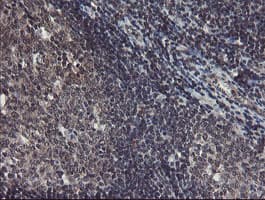 TDO2 Antibody (clone OTI2A4)