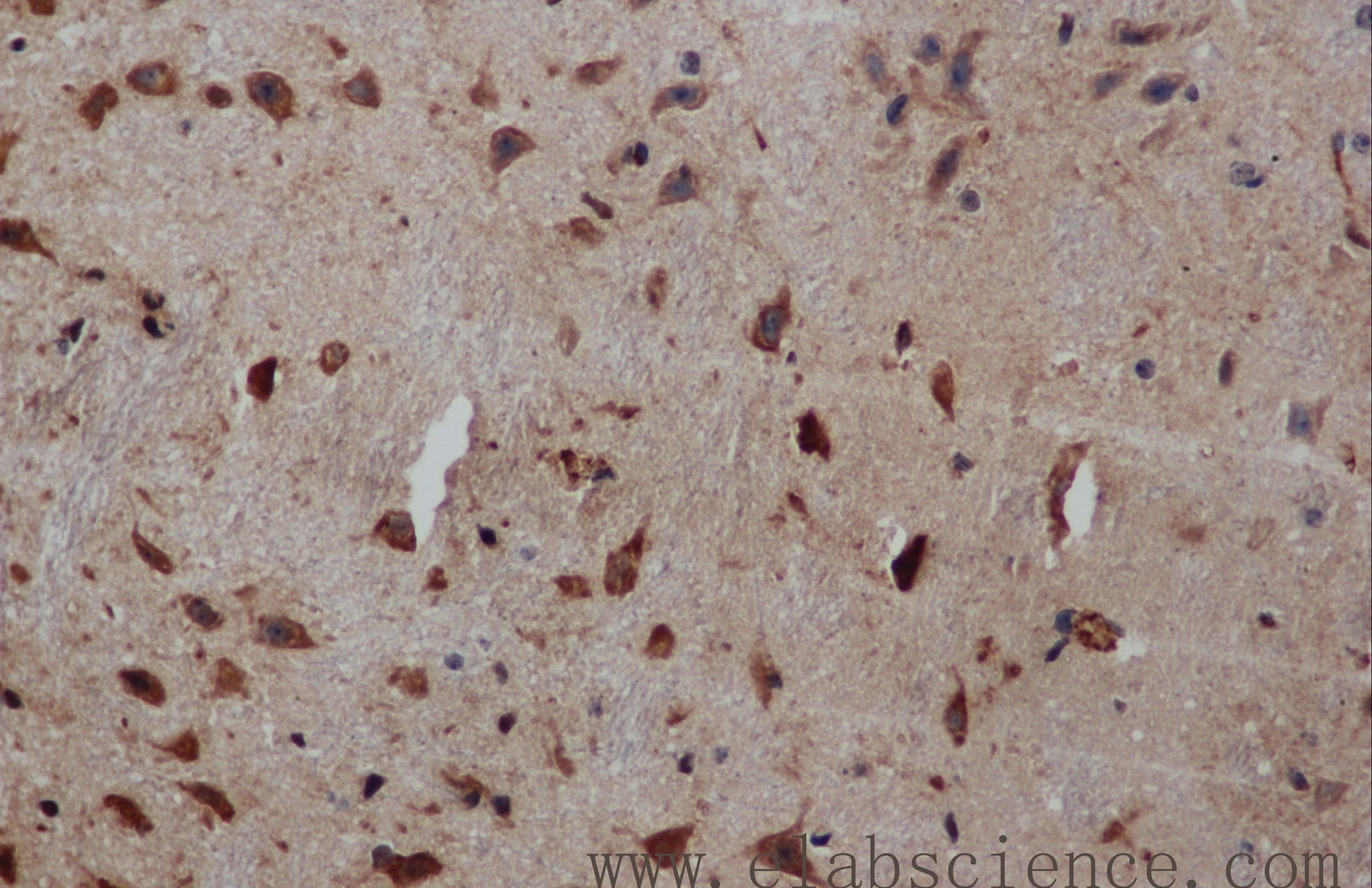 PIK3CB / PI3K Beta Antibody