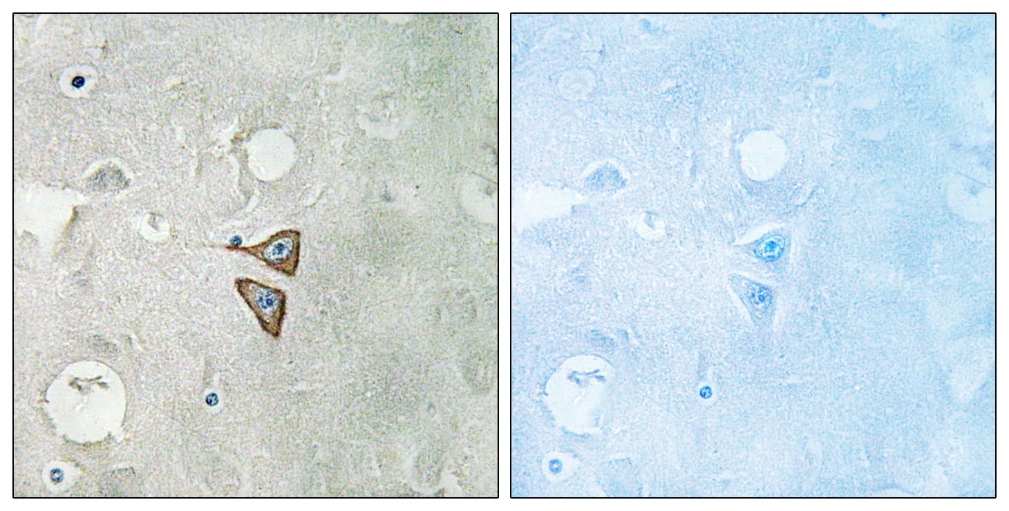 Polyclonal Rabbit anti-Human OPRD1 / Delta Opioid Receptor Antibody (aa323-372, IHC, WB)