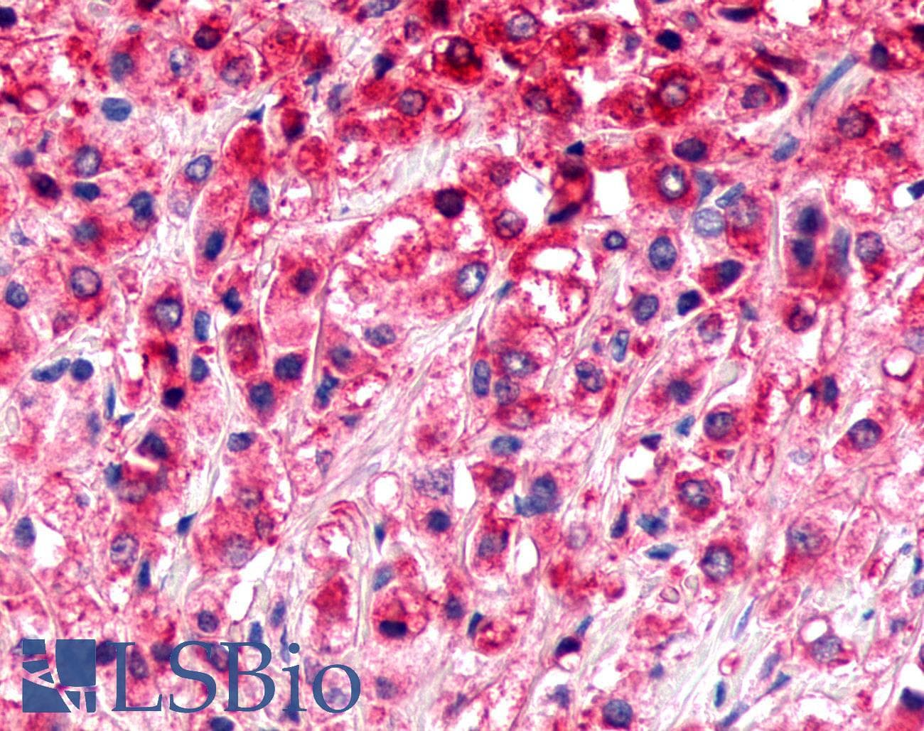 PathPlus™ ADGRL4 / ELTD1 Antibody (N-Terminus)