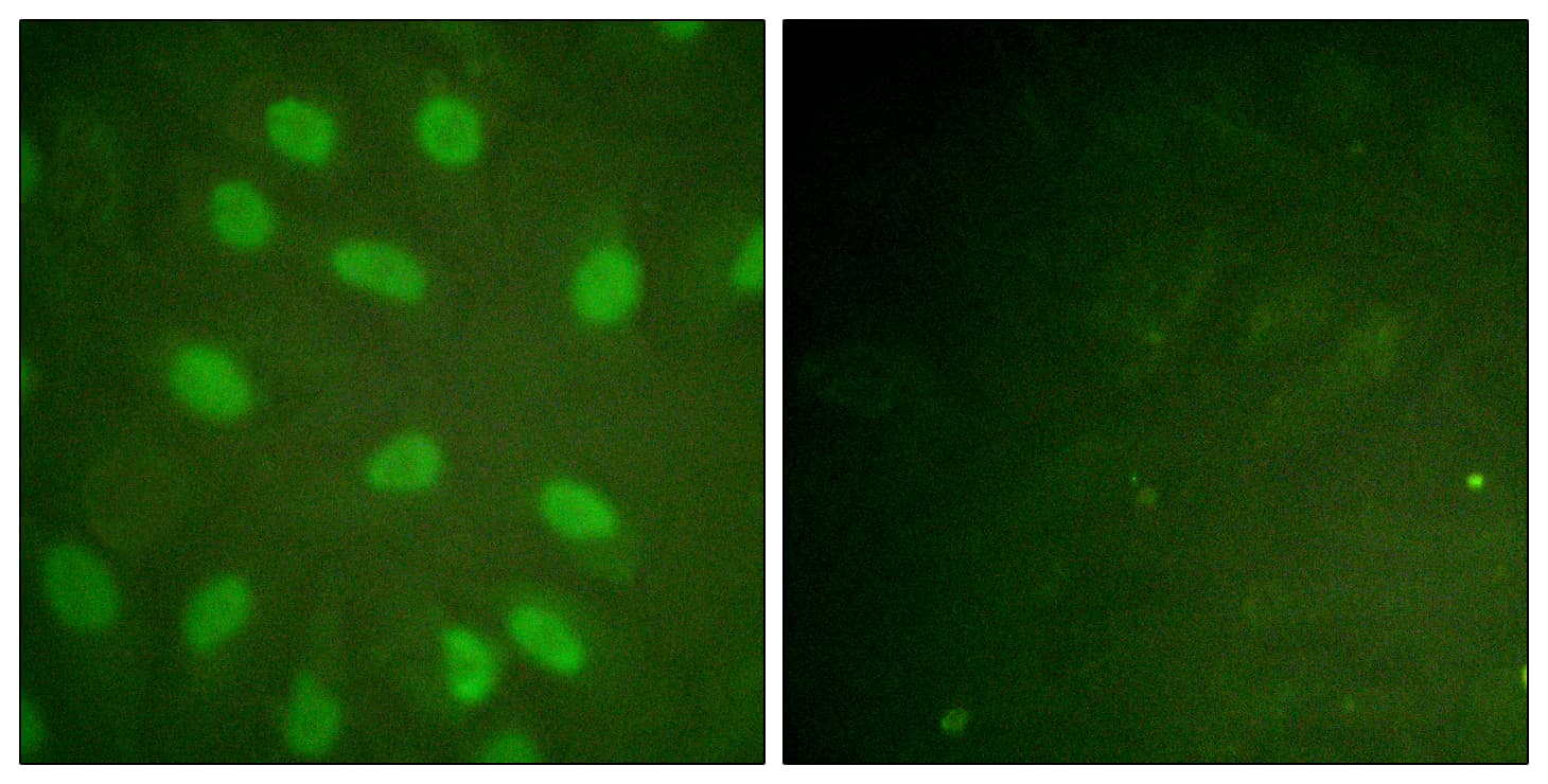 Polyclonal Rabbit anti-Human XRCC5 / Ku80 Antibody (phospho-Thr714, IHC, IF, WB)