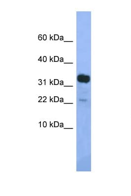 Polyclonal Rabbit anti-Mouse KLHDC9 Antibody (aa261-310, WB)