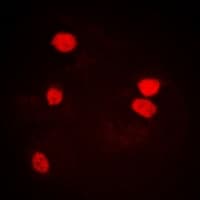 Polyclonal Rabbit anti-Human LSM4 Antibody (IHC, IF, WB)