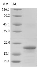 Bordetella bronchiseptica BB3856 Protein (Recombinant 10His, N-terminus + Myc, C-terminus)