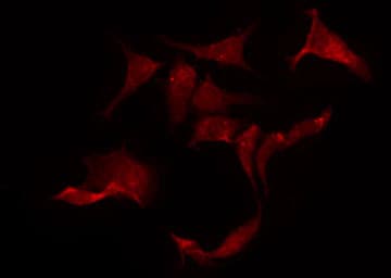Polyclonal Rabbit anti-Human CHRNA10 Antibody (IF, WB)