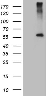 CPM / Carboxypeptidase M Antibody (aa124-423, clone OTI1C10)