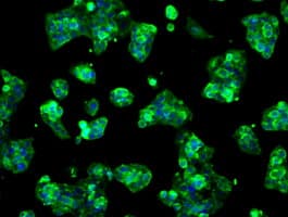 IHC-plus™ LOX / Lysyl Oxidase Antibody (clone 9A11)