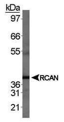 RCAN1 / DSCR1 Antibody (aa40-90)