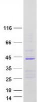 Human MBNL3 Protein (Recombinant Myc-DDK (Flag))