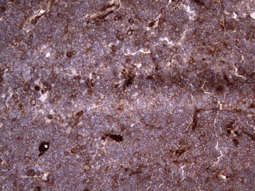 LGALS3 / Galectin 3 Antibody (clone OTI6E1)