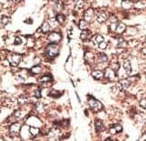 MAGEA11 Antibody (aa198-228)