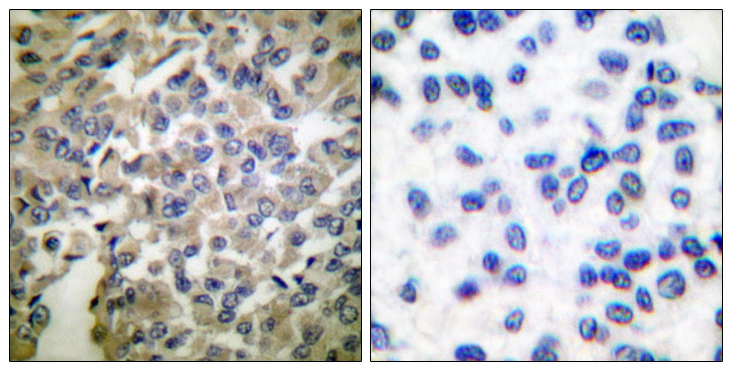 SYT1 / Synaptotagmin Antibody (p309)
