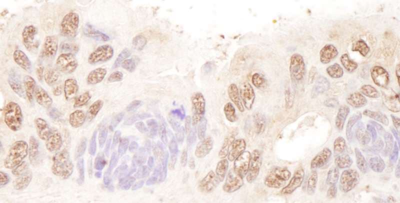 BTF / BCLAF1 Antibody (aa300-350)
