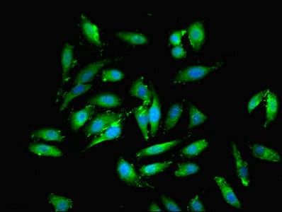 EML2 / EMAP2 Antibody (aa1-418)