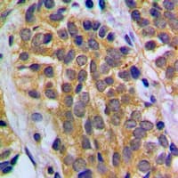 HEXB Antibody (C-Terminus)