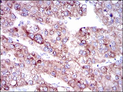Monoclonal Mouse anti-Human SLC27A5 / BACS Antibody (clone 9C4D1, aa508-570, IHC, WB)