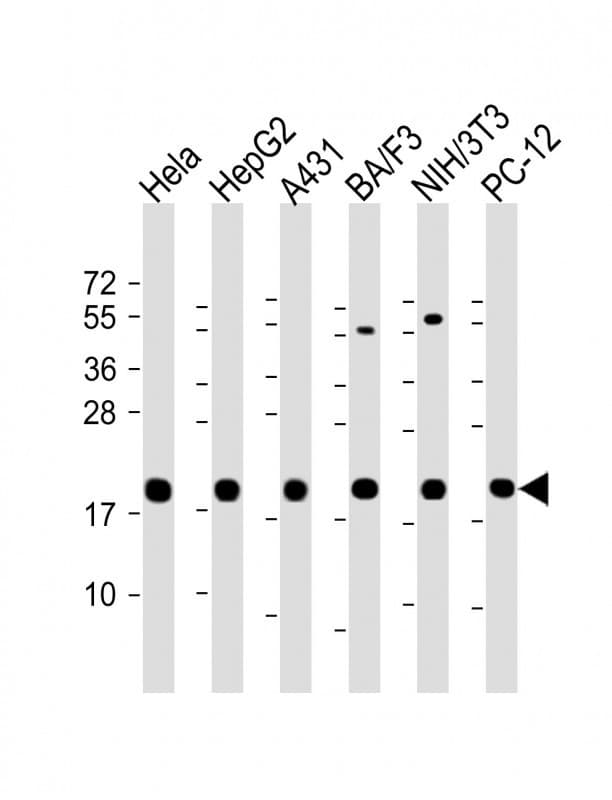 PPIB / Cyclophilin B Antibody