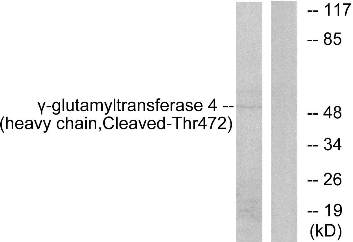 GGT7 Antibody (heavy chain, Cleaved-Thr472)