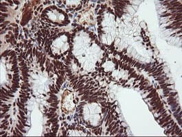 TRIM38 Antibody (clone OTI113D3)