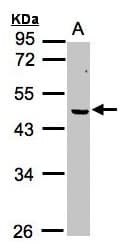 Polyclonal Rabbit anti-Human CSA / ERCC8 Antibody (IF, WB)