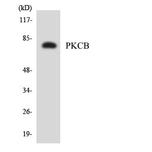 IHC-plus™ PRKCB / PKC-Beta Antibody (aa606-655)