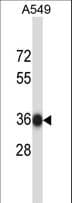 Polyclonal Rabbit anti-Human NAPB / SNAPB Antibody (aa13-40, WB)