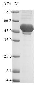 Vaccinia Virus Smallpox-B5R Protein (Recombinant MBP, N-terminus + 6His, C-terminus)
