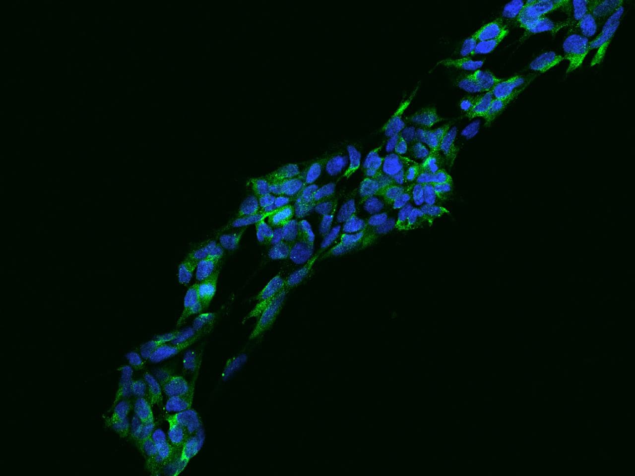 ULBP1 Antibody