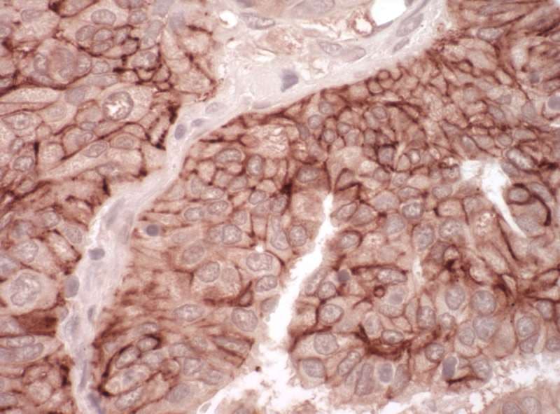 CXADR Antibody (aa335-365)