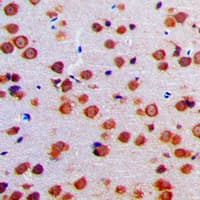 PRSS33 Antibody (Internal)