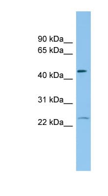Polyclonal Rabbit anti-Human FTH1 / Ferritin Heavy Chain Antibody (N-Terminus, WB)