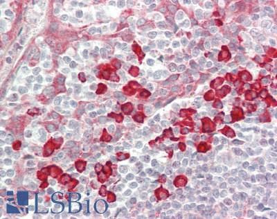 IHC-plus™ SENP6 Antibody (aa1081-1112)