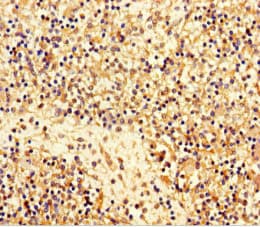 C11orf85 Antibody