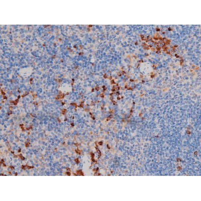 AKT1 Antibody (phospho-Ser124)