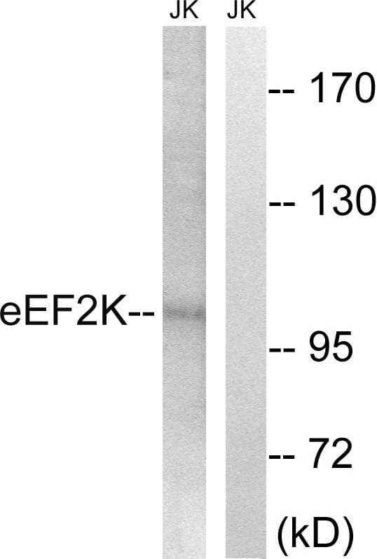 EEF2K Antibody (p359)