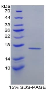 Mouse RBP1 / CRBP Protein (Recombinant His)